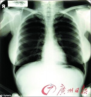 梦露三张胸部X光片 以4.5万美元高价被拍出(图)